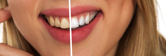 Dentální hygiena není jen o správném čištění chrupu